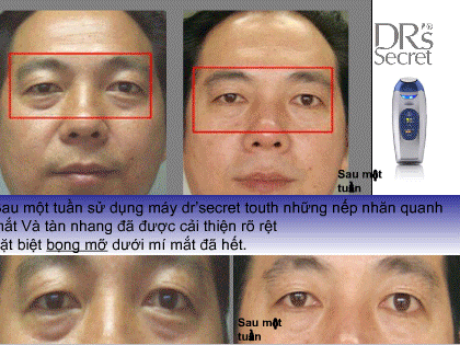may cham soc da mat